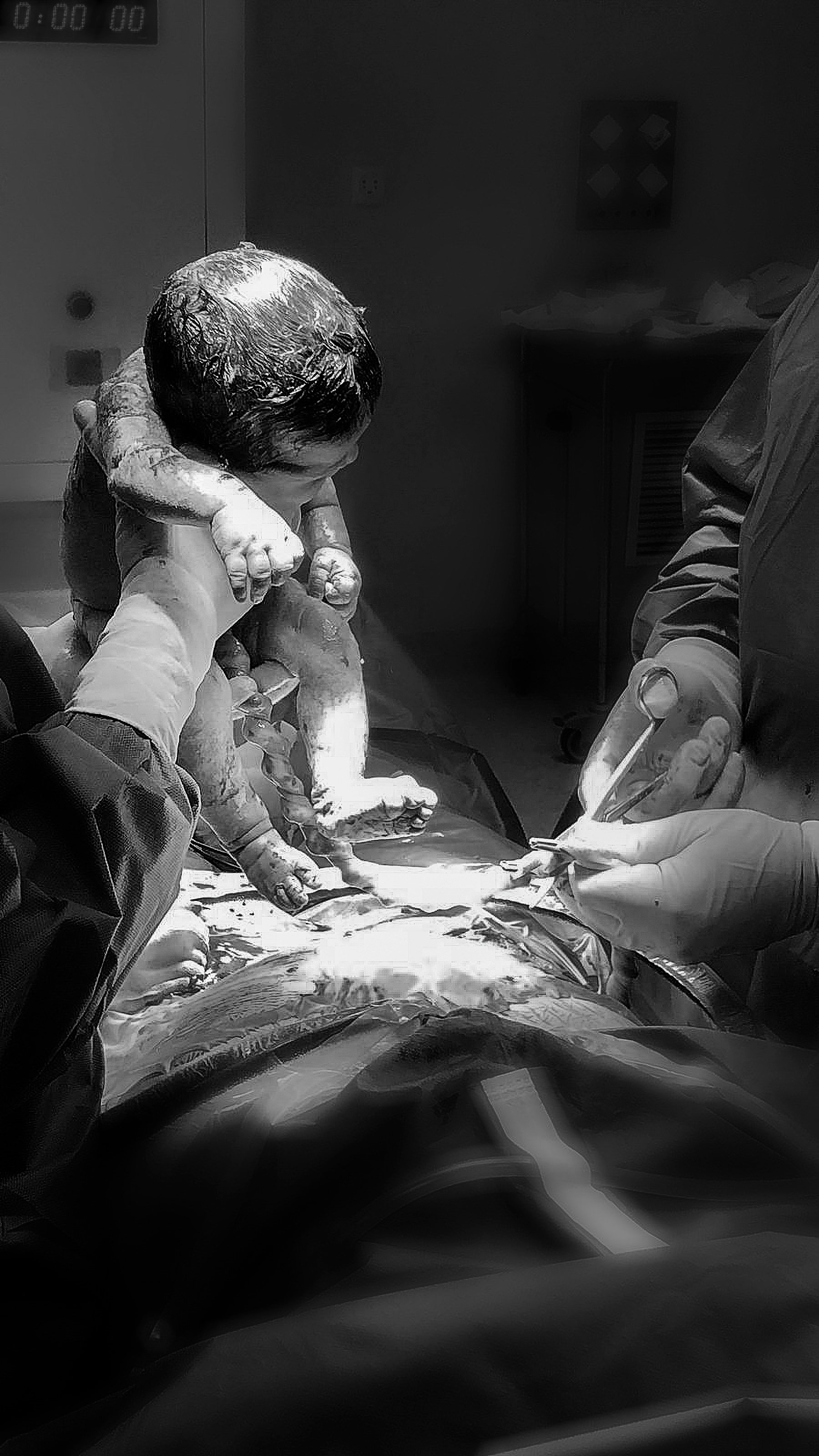 Foto de Parto en hospital parque San Antonio 3 Foto de Parto en hospital parque San Antonio 3